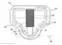 Fig. 01 - Orthopedic support pad assembly and method for providing permanent relief zones