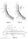 Fig. 03 - Orthopedic support pad assembly and method for providing permanent relief zones