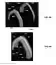 Fig. 05 - ORAL SECUREMENT APPLIANCE