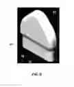 Fig. 06 - ORAL SECUREMENT APPLIANCE