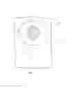 Fig. 02 - Ostomy pouch assembly