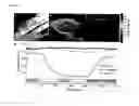 Fig. 06 - PREVENTION & TREATMENT OF NEUROPATHY