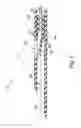 Fig. 07 - Sub-retinal tangential needle catheter guide and introducer