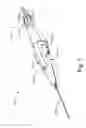 Fig. 08 - Sub-retinal tangential needle catheter guide and introducer