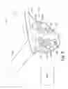 Fig. 09 - Sub-retinal tangential needle catheter guide and introducer