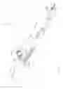 Fig. 33 - Sub-retinal tangential needle catheter guide and introducer