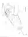 Fig. 43 - Sub-retinal tangential needle catheter guide and introducer