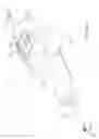 Fig. 44 - Sub-retinal tangential needle catheter guide and introducer