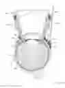 Fig. 74 - Sub-retinal tangential needle catheter guide and introducer