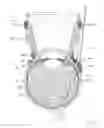 Fig. 76 - Sub-retinal tangential needle catheter guide and introducer