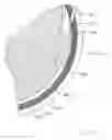 Fig. 79 - Sub-retinal tangential needle catheter guide and introducer