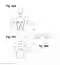 Fig. 14 - Pair of eye goggles