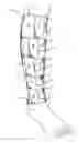 Fig. 01 - COMPRESSION GAUGE FOR THERAPEUTIC COMPRESSION GARMENTS