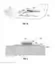 Fig. 04 - Prophylactic dressing and use of same in the prevention of infection