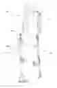Fig. 01 - Reconfigurable exoskeleton