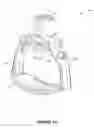 Fig. 02 - Adjustable piston