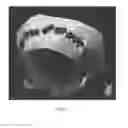 Fig. 03 - Drug delivery means