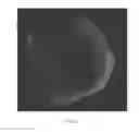 Fig. 05 - Drug delivery means