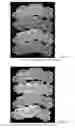 Fig. 41 - Drug delivery means
