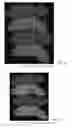 Fig. 42 - Drug delivery means