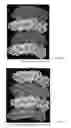 Fig. 46 - Drug delivery means