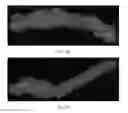 Fig. 47 - Drug delivery means