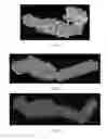 Fig. 49 - Drug delivery means
