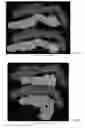 Fig. 53 - Drug delivery means