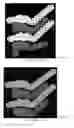 Fig. 55 - Drug delivery means