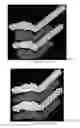 Fig. 56 - Drug delivery means