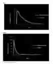 Fig. 03 - VALSARTAN-AMLODIPINE COMPOUND SOLID PREPARATION AND PREPARATION METHOD THEREFOR