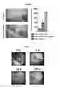 Fig. 11 - Pharmaceutical composition for protecting wounds, providing hemostasis, or preventing adhesion in the gastrointestinal tract