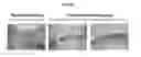 Fig. 12 - Pharmaceutical composition for protecting wounds, providing hemostasis, or preventing adhesion in the gastrointestinal tract