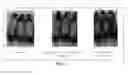 Fig. 08 - COMPOSITION FOR TOPICAL SKIN APPLICATION CONTAINING GINSENOSIDE F2 DERIVED FROM HYDROPONIC GINSENG