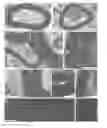 Fig. 01 - Induced pluripotent cell-derived oligodendrocyte progenitor cells for the treatment of myelin disorders