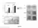 Fig. 07 - Notch Ligand Bound Biocompatible Substrates And Their Use In Bone Formation