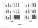 Fig. 08 - Notch Ligand Bound Biocompatible Substrates And Their Use In Bone Formation