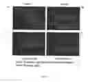 Fig. 02 - Method and compositions for genetic and retinal disease
