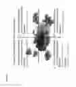 Fig. 03 - Method for preparing an immunogenic lysate, the lysate obtained, dendritic cells loaded with such lysate and a pharmaceutical composition comprising the lysate or the dendritic cells