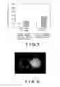 Fig. 04 - METHOD FOR ACCUMULATING TITANIUM OXIDE COMPOSITE PARTICLES INTO A CANCER TISSUE