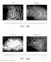 Fig. 18 - APPARATUS FOR FACILITATING CELL GROWTH IN AN IMPLANTABLE SENSOR