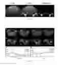Fig. 02 - Magnetic nanoparticle composition and manufacturing method and use thereof