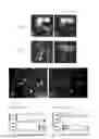Fig. 02 - MR IMAGING DIAGNOSTIC AGENT FOR INTRACTABLE NEUROLOGICAL DISEASE