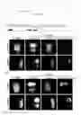 Fig. 03 - MR IMAGING DIAGNOSTIC AGENT FOR INTRACTABLE NEUROLOGICAL DISEASE