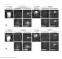 Fig. 04 - MR IMAGING DIAGNOSTIC AGENT FOR INTRACTABLE NEUROLOGICAL DISEASE
