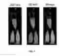 Fig. 06 - Compositions and methods for treatment and imaging using nanoparticles