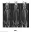 Fig. 07 - Compositions and methods for treatment and imaging using nanoparticles