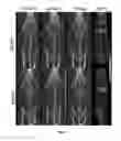 Fig. 15 - Compositions and methods for treatment and imaging using nanoparticles