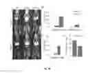Fig. 16 - Compositions and methods for treatment and imaging using nanoparticles