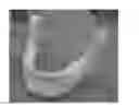 Fig. 01 - ARTIFICIAL BONE FORMS AND COMPOSITIONS FOR APPROXIMATING BONE